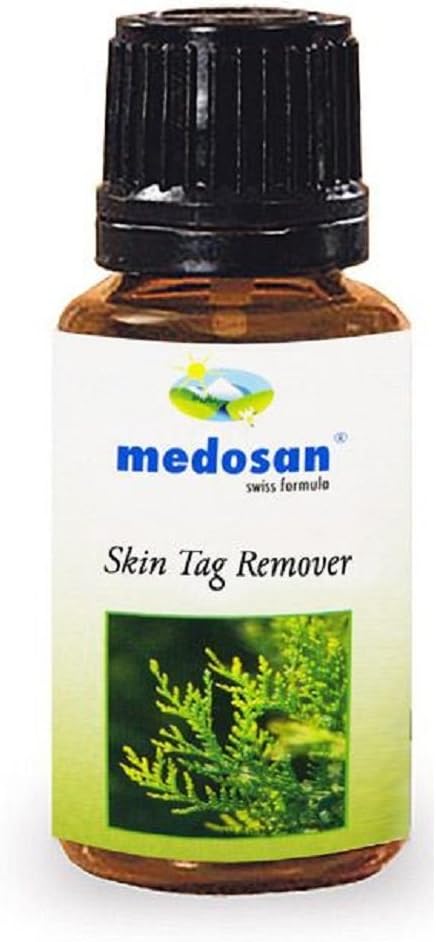 Skin Tag Remover Pain Free Natural Homeopathic Thuja Occidentalis