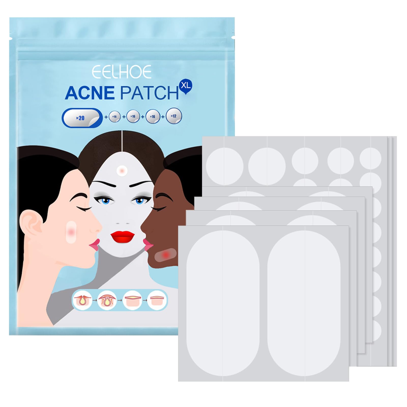 Hydrocolloid Patches, (80 Patches) Acne Pimple Spot Patch for Large Zit Breakoutse, Face Chin and Body Mighty Dots for Spots Treatment with Tea Tree & Calendula Oil Hydrocolloid