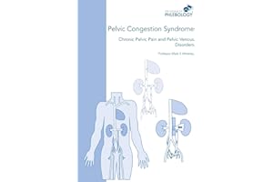 Pelvic Congestion Syndrome - Chronic Pelvic Pain and Pelvic Venous Disorders