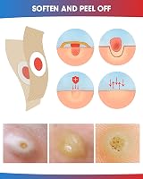 MYMULIKE Corn Removal Pads 48 Count Foot Care Cushion Plasters view 8