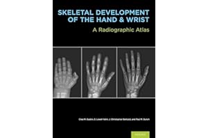 Skeletal Development of the Hand and Wrist: A Radiographic Atlas and Digital Bone Age Companion