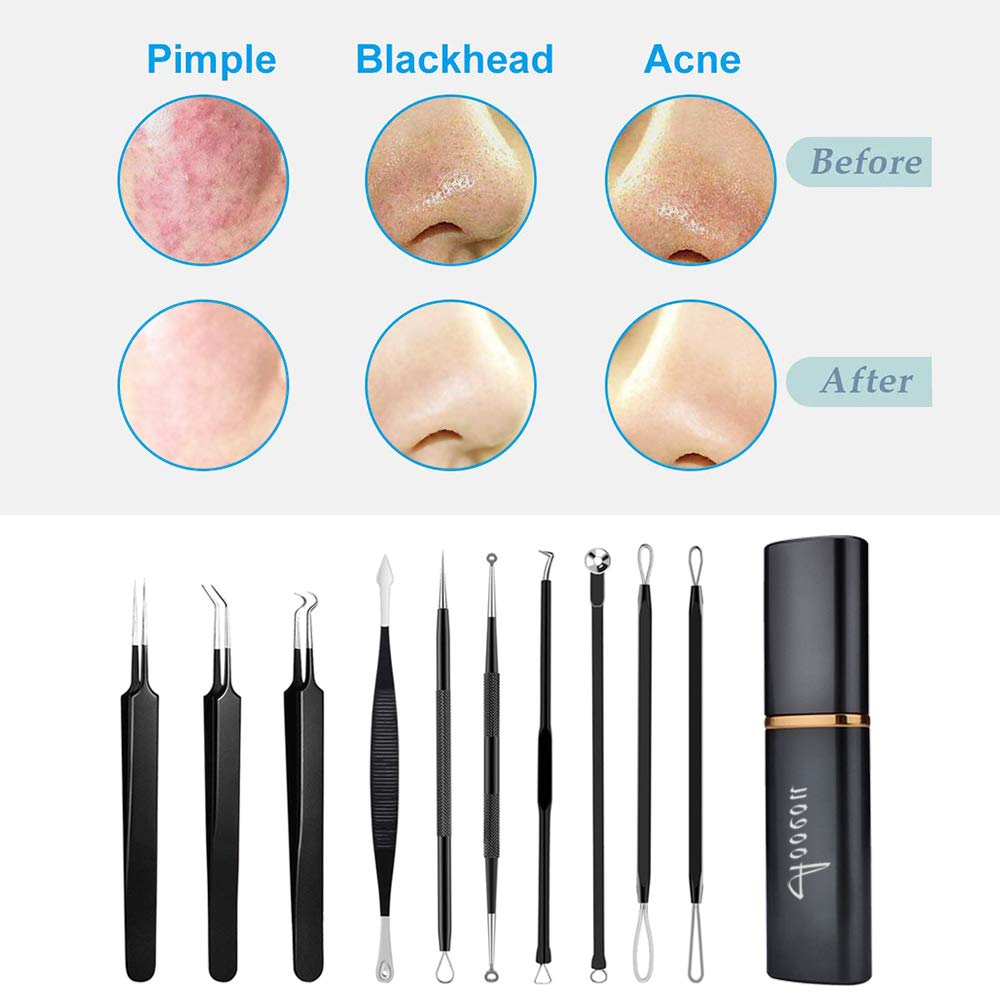pimple popper tool- Aooeou 10 Pcs Professional Pimple Comedone Extractor Tool Acne Removal Kit -Treatment for Pimples, Blackheads, Blemish, Zit Removing, Forehead and Nose: Beauty
