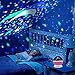 Alenbrathy Night Light Lamp, Star Projector Romantic, LED Night Light 360 Degree Rotation, 4 LED Bulbs 9 Light Color Changing with USB Cable, Best Gift for Men Women Teens Kids Children, Pink