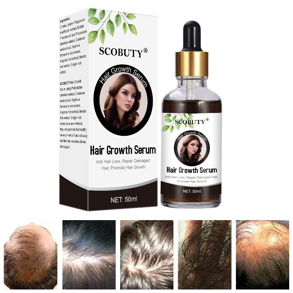 Hair Growth Serum, Hair Growth Oil, Hair Growth Treatment, Hair Loss Serum for Thinning, Balding, Repairs Hair Follicles, Promotes Thicker, Stronger Hair, And Promotes Hair Regrowth, 50ml : Beauty
