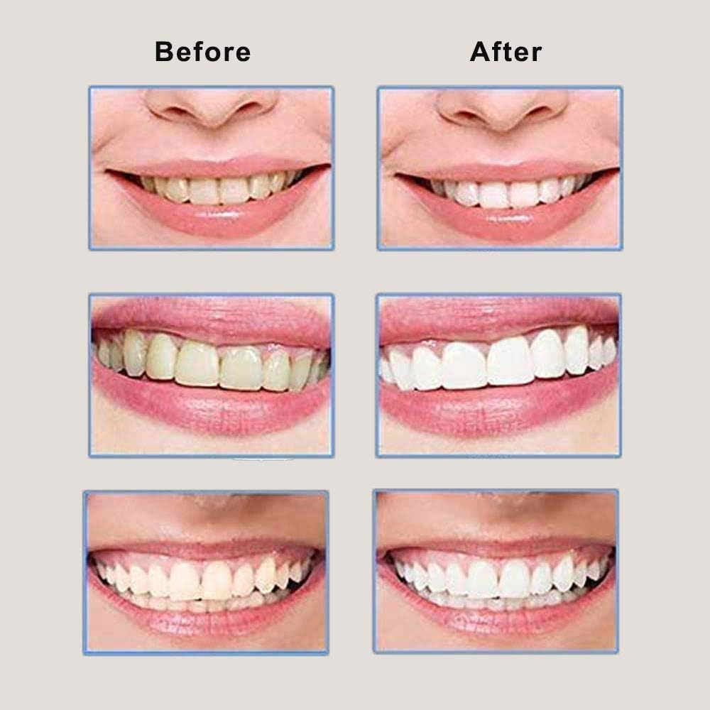 Fausse Dents Blanche Dentier Esthetique Haut Et Bas Sourire Parfait Temporaire Amovible Simulations En Silicone Prothese Pour Beaute Amazon Fr Cuisine Maison