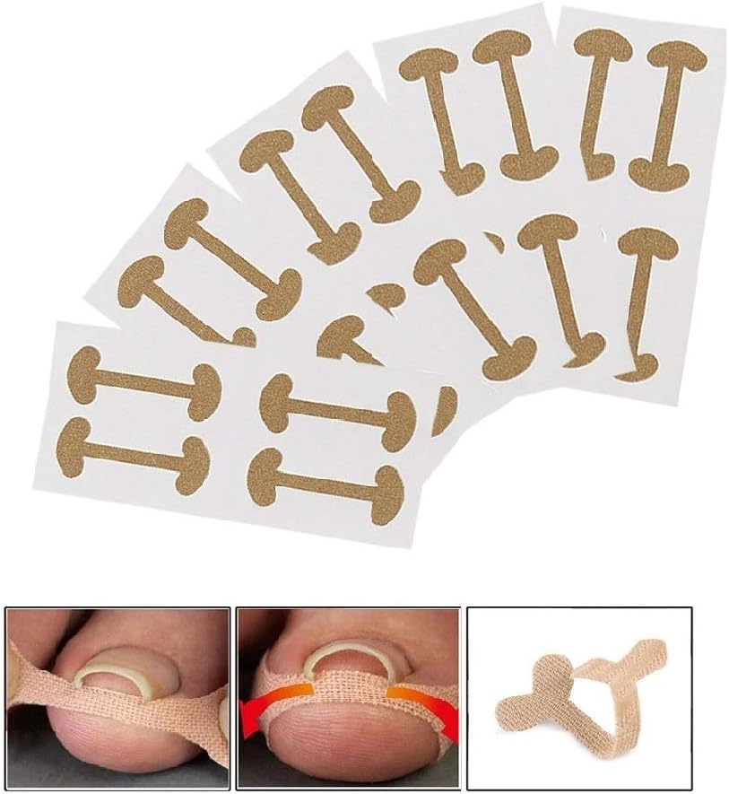 EBANKU 5 Sheets/20 Pcs Ingrown Toenail Corrector Stickers, Toe Nail Treatment Elastic Patch Sticker Corrector Pedicure Tools Fingernail Toe Nail Care Protects Toe Nail: Arts, Crafts & Sewing