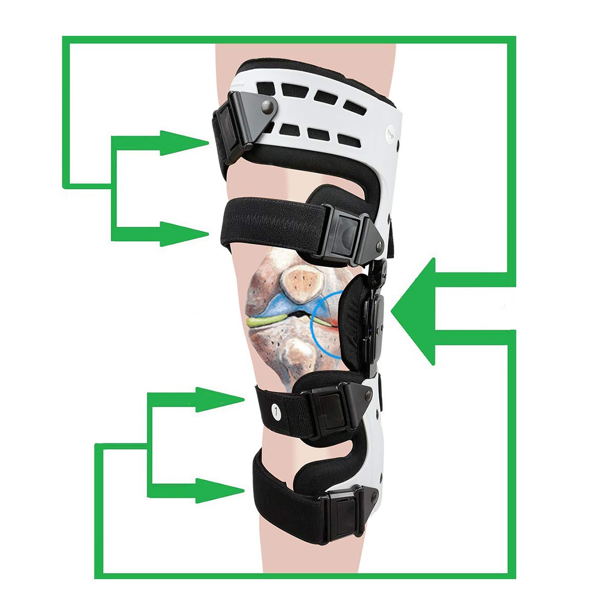 Orthomen OA Unloader Knee Brace Lateral/Outside Support for Arthritis