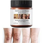 Dark Knees Remover Underarm Cream Body Moisturizer Lotion Dark Toe Knuckles Treatment Removal Remover Corrector for Armpit Elbow Inner Thigh Neck Private Part Intimate Legs Skin Cream - 120g/4.21oz