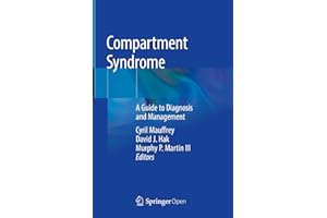 Compartment Syndrome: A Guide to Diagnosis and Management