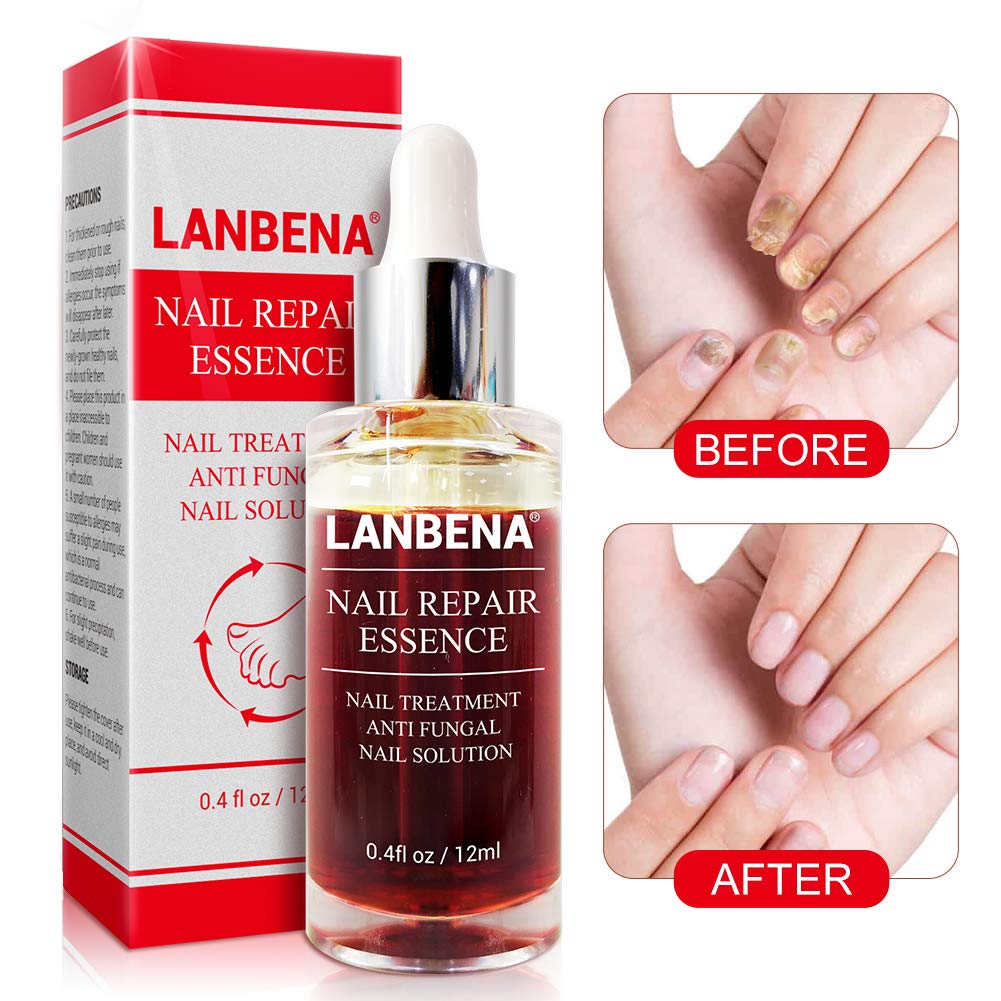 Nails Repair, LANBENA Nail Treatment Nail Care Serum Protect Nail from Damage Fingernail and Toenail Repair for Curing Athlete's Foot and Prevent Nail from Infection Discolored & Damaged Nails(12ml) : Beauty