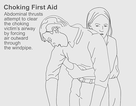 Amazon.com: Heimlich Maneuver Poster Print by Gwen ShockeyScience ...