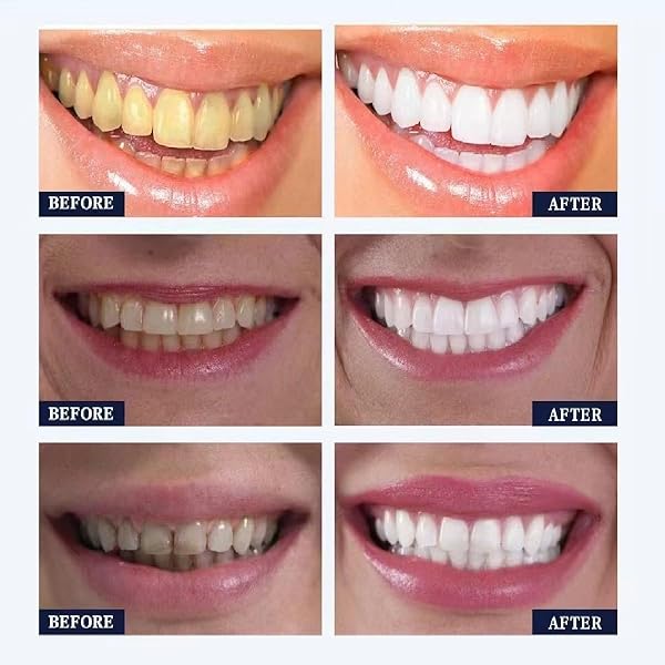 2PCS MIYANXI TOOTH CLEANING POWDER,NATURAL KAOLIN, TEETH WHITENING POWDER,EFFECTIVE REMOVER STAINS FROM COFFEE SMOKING.