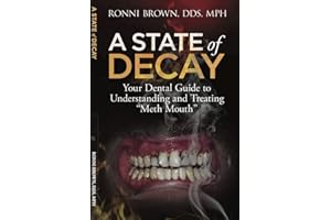 A State of Decay: Your Dental Guide to Understanding and Treating "Meth Mouth"