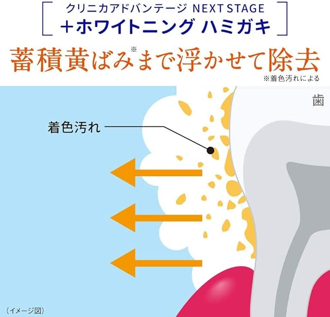 Amazon Co Jp限定 クリニカ アドバンテージnext Stage 医薬部外品 ホワイトニング ハミガキ フロス 高濃度フッ素 1450ppm配合 リフレッシュミント 87g クリニカ ビューティー 通販 Amazon