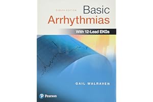 Basic Arrhythmias