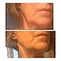 Customer image