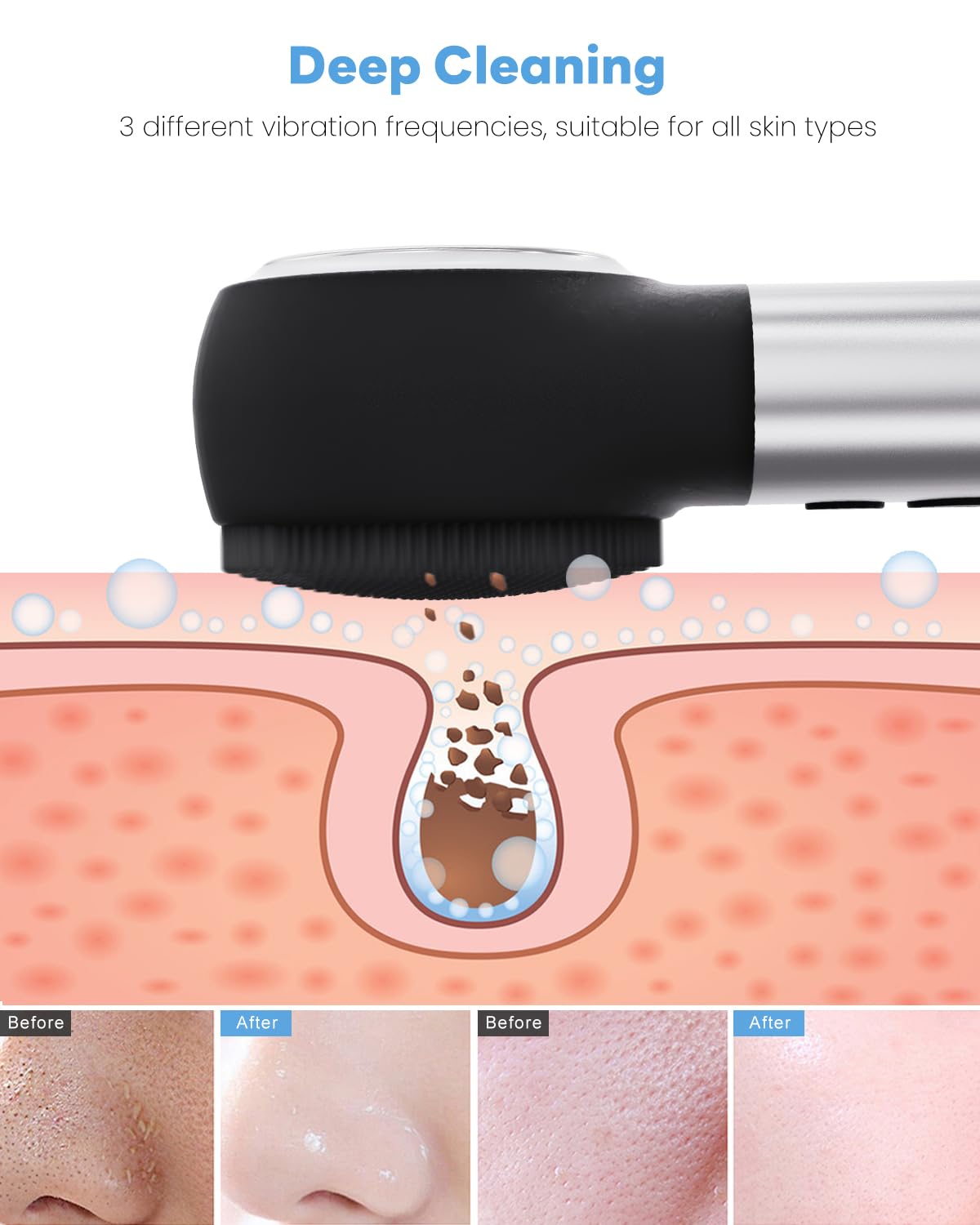 CozyZen Facial Cleansing Brush, IPX7 Waterproof and Rechargeable Silicone Face Scrubber, Heat & Cold Massage for Men & Women (Black)