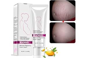 YINRUNX 3Pack Stretch Mark Cream for Pregnancy & Scar Removal,Stretch Marks and Scar Removal Cream for Pregnancy,Stretch Mark Remover, Strech Mark Gone Cream, Scar Removal Cream,Pregnancy Must Haves