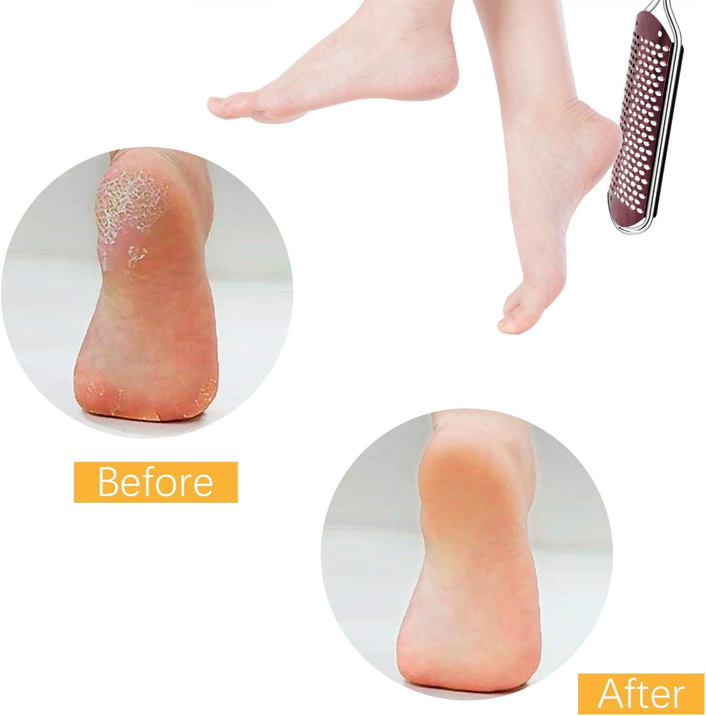 Pedicure Foot File Callus Remover - Image 4