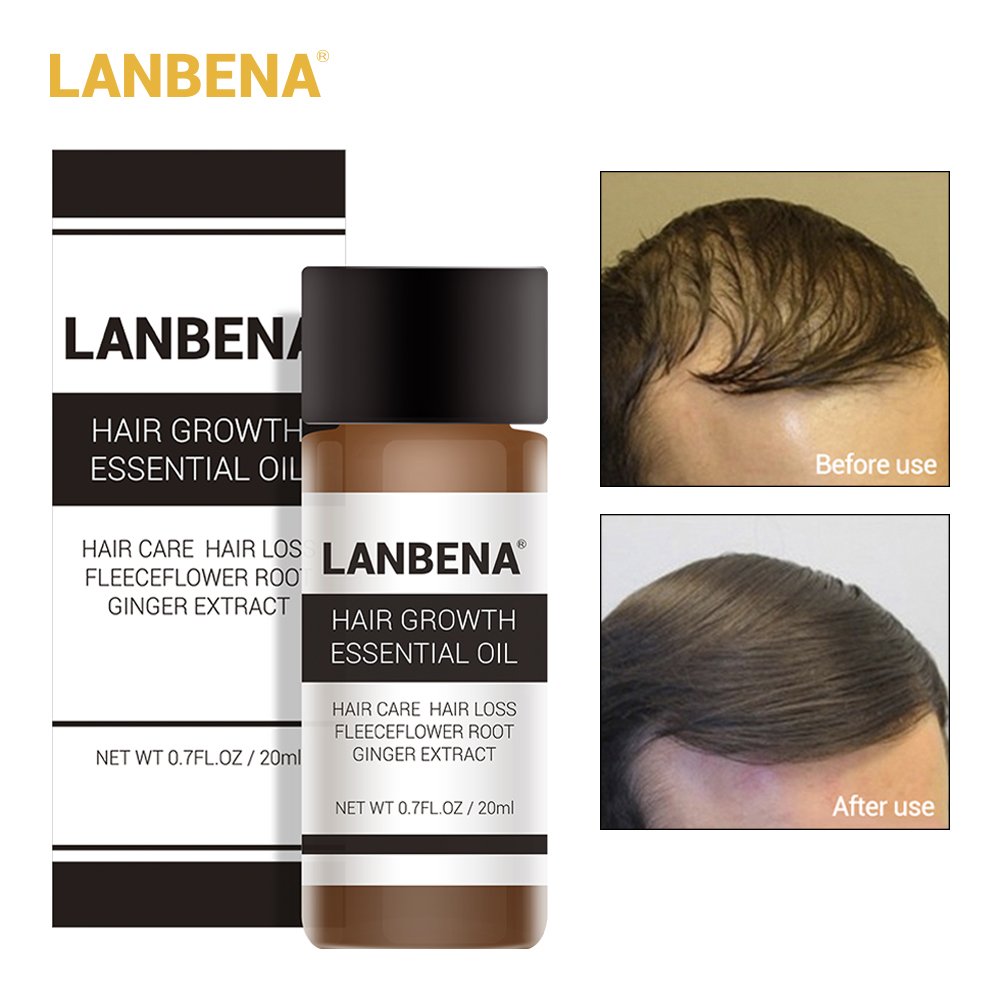 Buy Generic Lanbena 20ml Hair Growth Essence Fast Powerful Hair