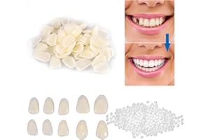 JREHOOR 100 Pcs A2 Color Dental Temporary Crown Veneers - Tooth Repair Kit for Missing & Broken Teeth, Orthodontic Care Solution - Temporary Fake Teeth Replacement Set