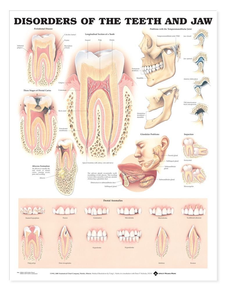 Disorders of the Teeth and Jaw