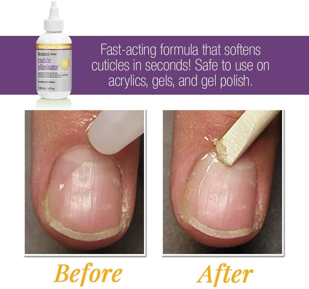 ProLinc Cuticle Eliminator, Removes Cuticles in Seconds, 4 oz: Beauty