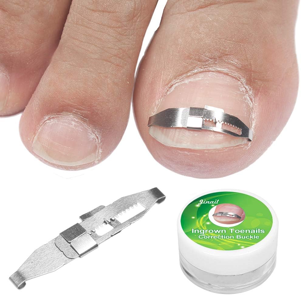 laizetongxun Stainless Steel Toe Nail Correction Toenail Straightening Clip Armor Corrector Patch Tool Set