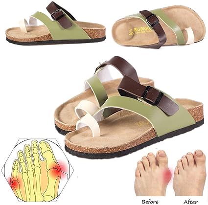 sandales homme hallux valgus