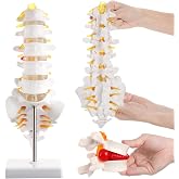 2Pcs Lumbar Spine Model 5 Vertebrae Herniated Disc Anatomical Models Set | Flexible Structure,Skeletal Model Anatomy,for Medical Students, Doctors,Education and Chiropractic,Therapy Teaching Learning