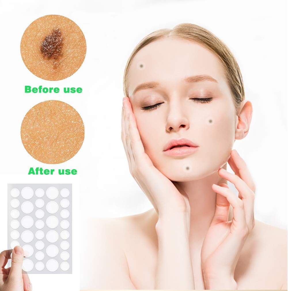 108 PCS Skin Tag and Acne Remover Patches Mole Remover Patches Covers and Conceals Skin Tag Removal Patches Tags Dries and Fall Away …: Health & Personal Care