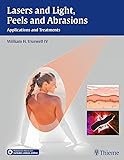 Lasers and Light, Peels and Abrasions: Applications