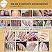 Mchoice Nail Treatment Essence Nail and Foot Whitening Toe Nail Fungus Removal