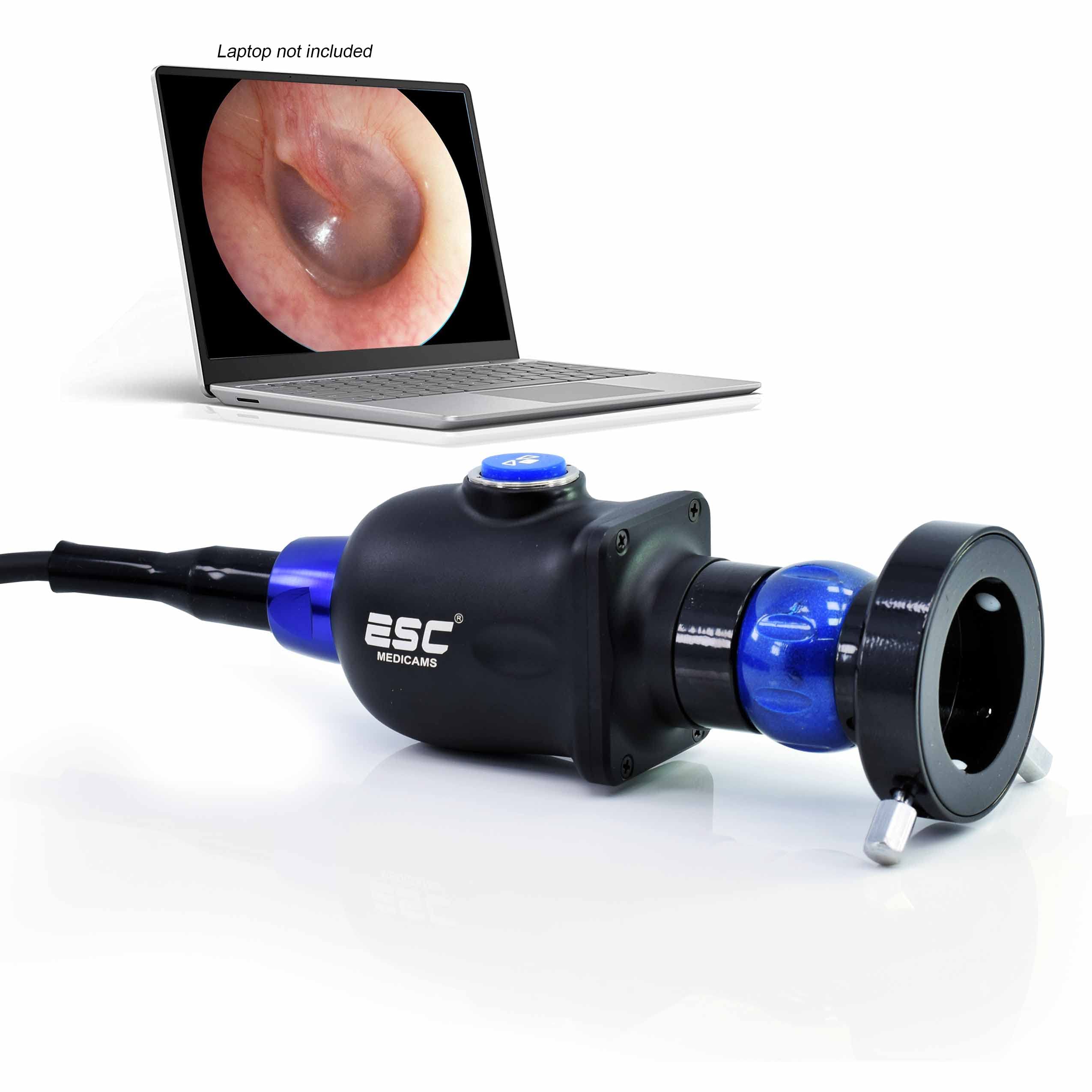 Photo 1 of ESC Medicams Endoscopy Camera Portable HD Rigid Ent w/Coupler Adapter 1.2 MP (Model : ENT-2000US-P) (119.000)