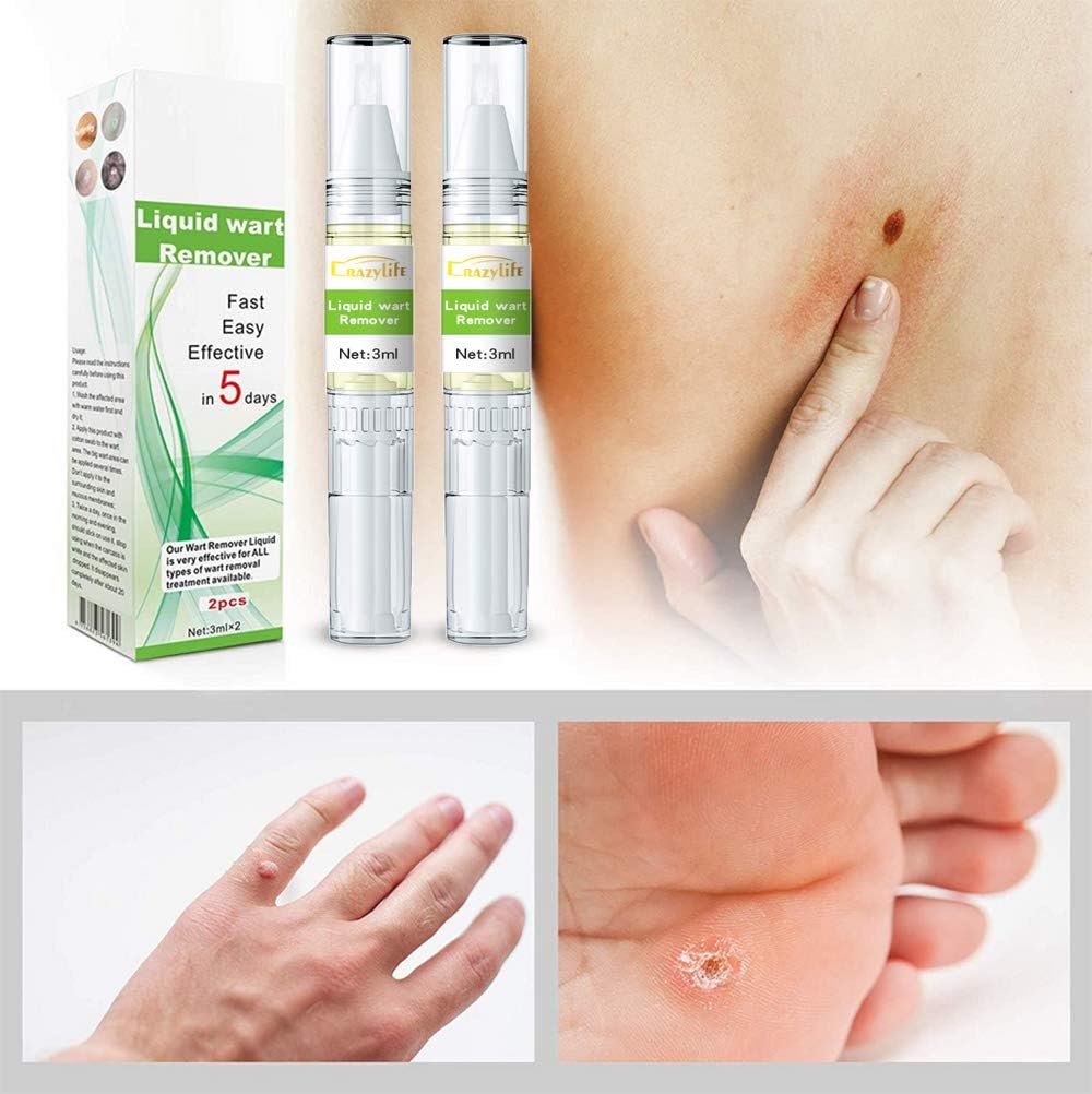 Skin Tag Remover Wart Remover for Neck Quickly Tag Mole Remover for Common and Plantar Warts,2pcs: Health & Personal Care