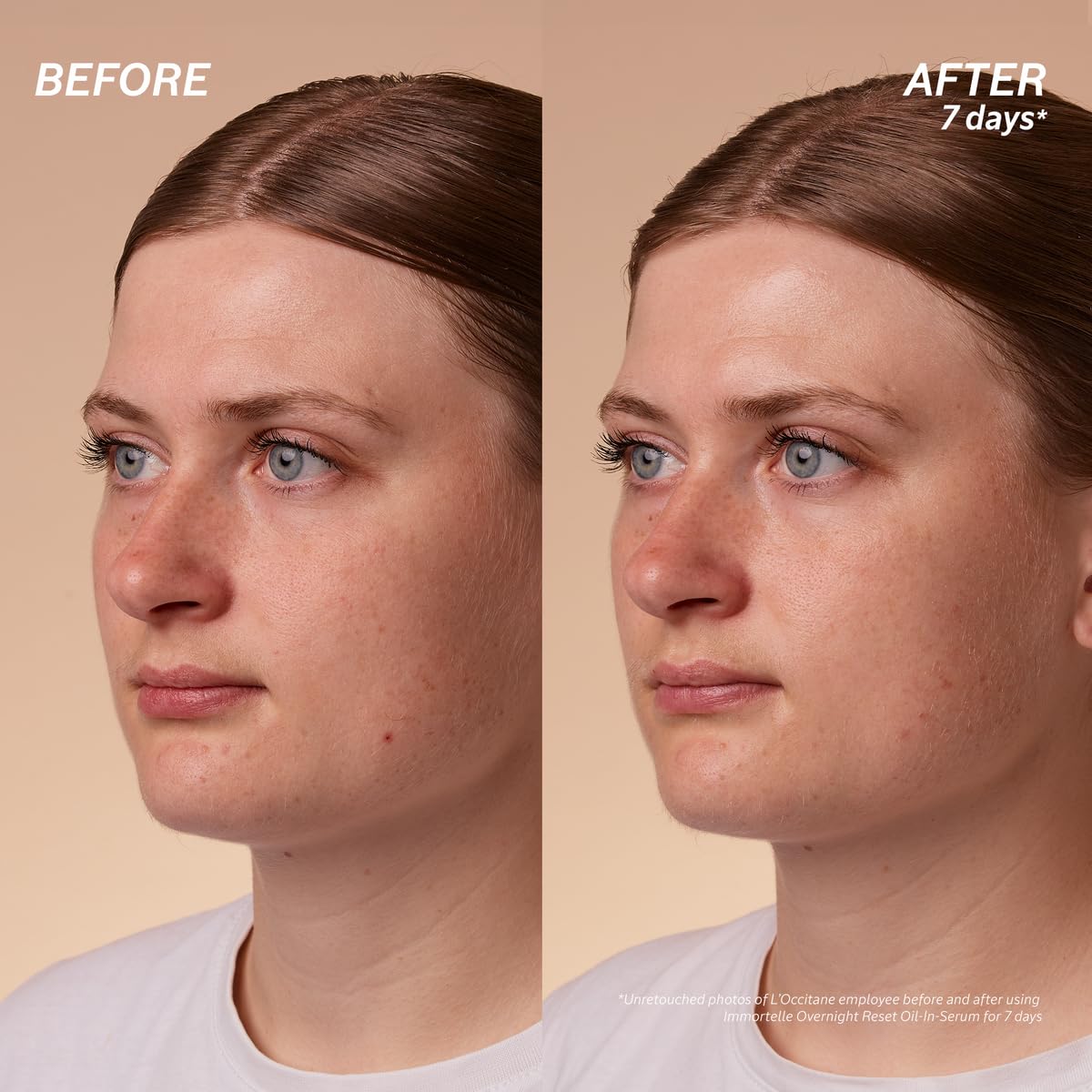 L'Occitane Immortelle Overnight Reset Oil-In-Serum: More Radiant Skin In 1 Night, Smooth Fine Lines, Revitalize Dull Skin, Award-Winner