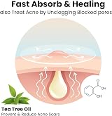 roselynboutique Hydrocolloid Acne Patches CICA Tea Tree SalicylicA 10mm 12mm 96 view 5