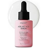 10% Azelaic Acid Serum with Niacinamide & Hyaluronic Acid – Rosacea Treatment For Face – Redness Relief, Blemish Relief, Brightening Skincare for Rosacea-Prone, Oily or Sensitive Skin, 30ml