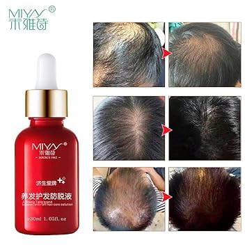 Buy Shreeyas Powder For Hair Growth Andrea Essence Anti Hair Loss