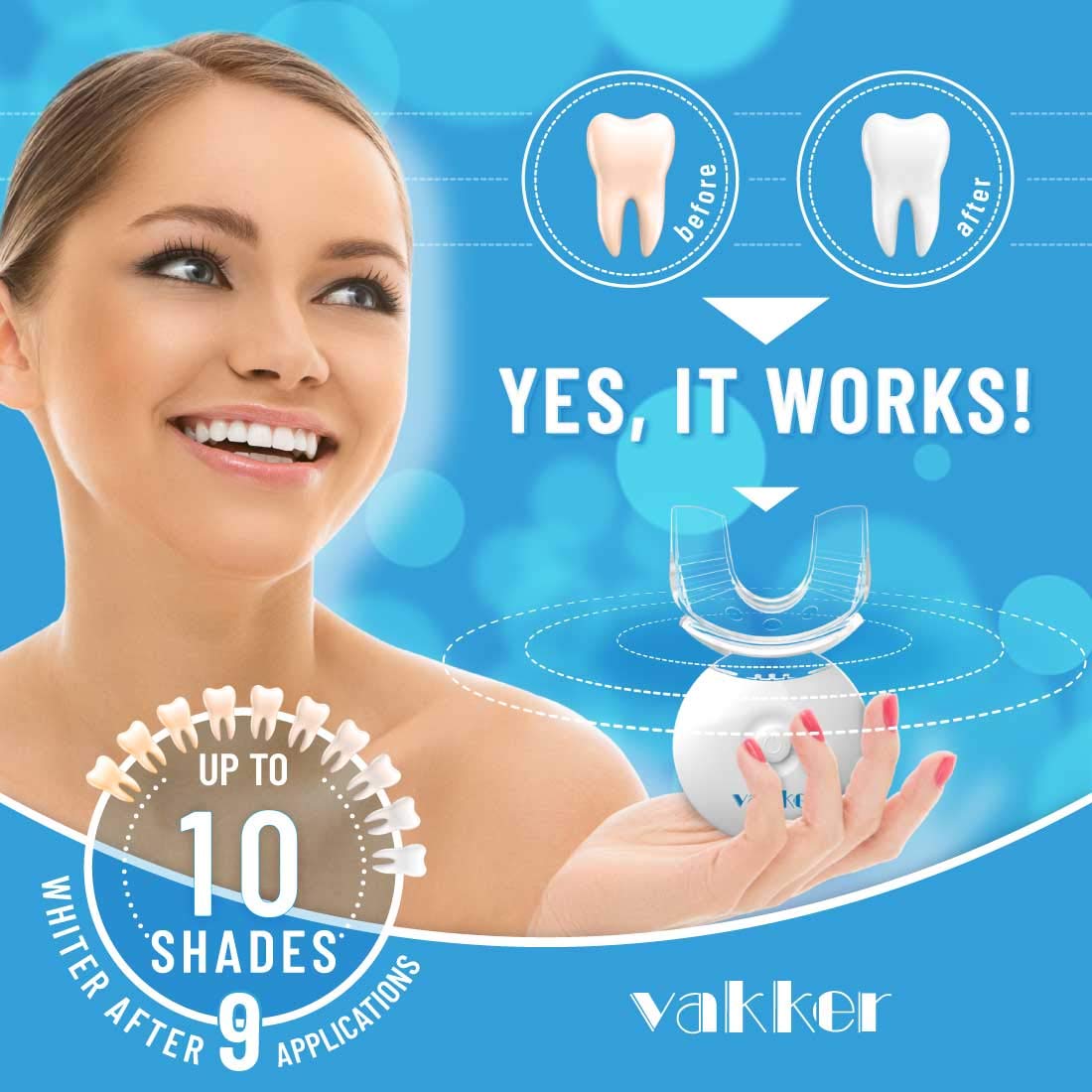 Vakker Teeth Whitening Kit with LED Light, 10min Fast-Result Teeth Whitener, 3 Non-Sensitive 35% Carbamide Peroxide Teeth Whitening Gel Pen and Tray to Help Remove Teeth Stain from Coffee Drinks Food: Beauty