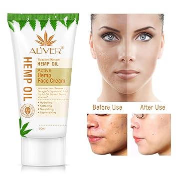 skin shrinking cream