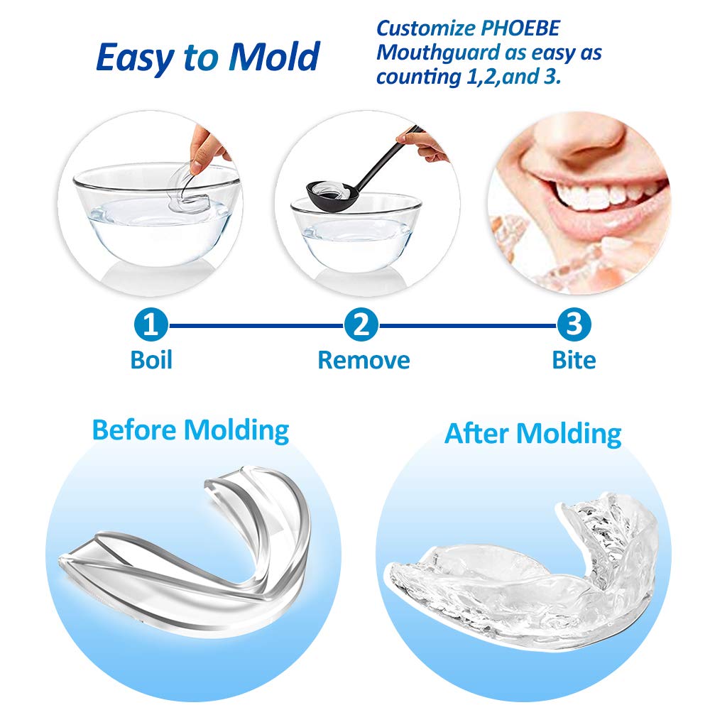 Mouth Guard for Grinding Teeth PHOEBE Night Dental Guards for Teeth