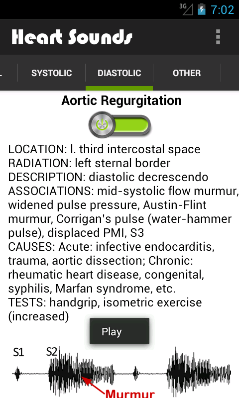 Heart Sounds (+ Lung Sounds)