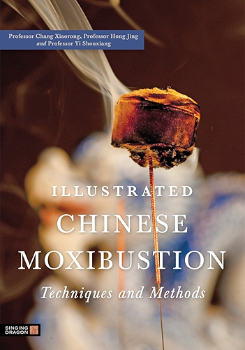 Download Illustrated Chinese Moxibustion Techniques and Methods (English Edition) PDF