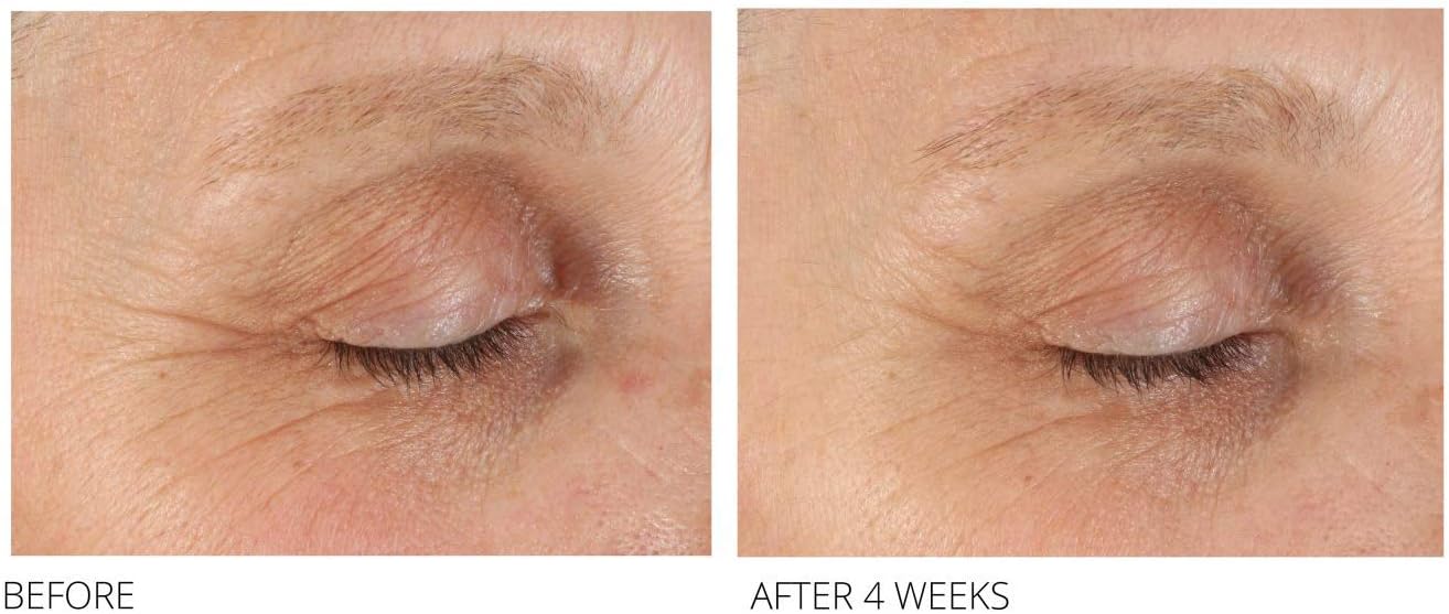 MEG 21 Bright and Firm Eye Treatment 15 g - Image 5