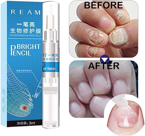 Foonee Mycose Des Ongles 3ml Traitement Ongles Traitement