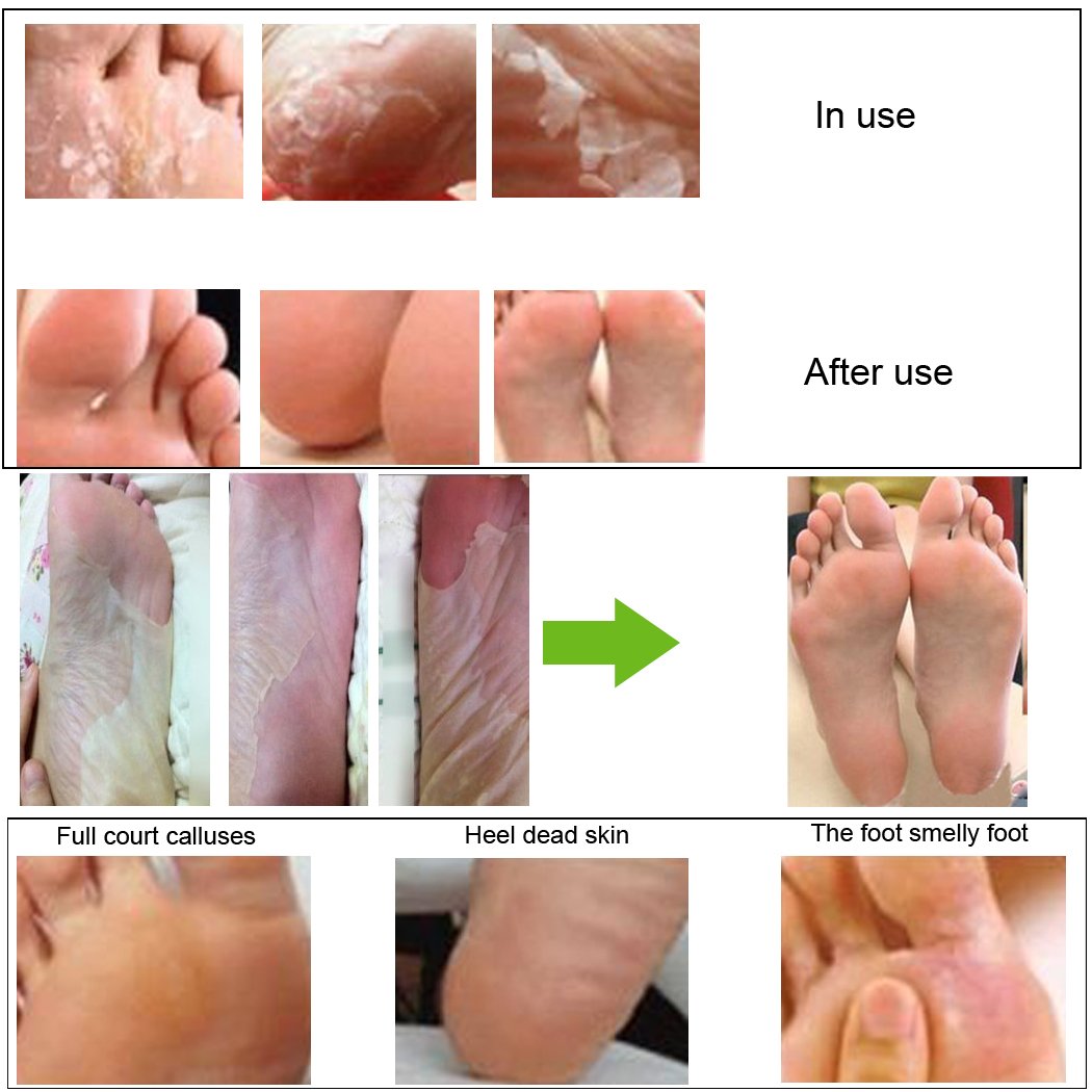 Mickee Dickin Baby Foot exfoliant Foot Peel deep Exfoliation Foot Peel exfoliating Foot Peel Fascinators