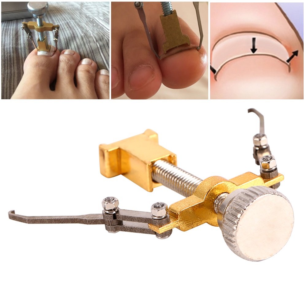 Professional Ingrown Toenail Correction Tool Medical Grade Ingrown