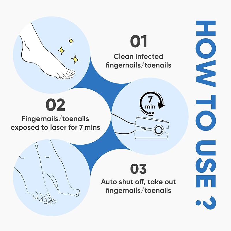 Dispositif de Laser pour Mycose Des Ongles, Berrlly Dispositif des Champignons des Ongles Portable Lumière Bleue 460nm Très Efficace, Facile à Utiliser à Maison pour Améliorer Ongles Endommagés (Noir) — photo 5 sur 8