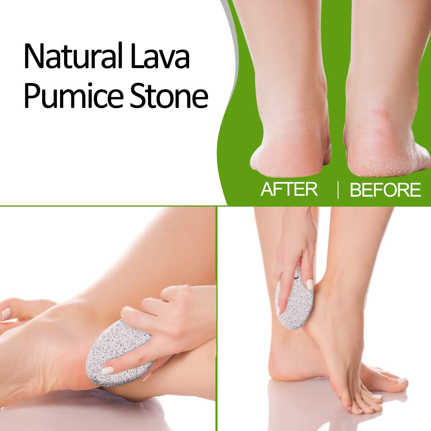 Natural Pumice Stone for Feet,2 Pack White Foot Pumice Stone for Feet